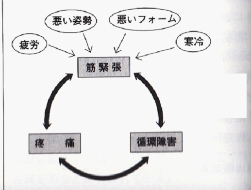 筋筋膜性腰痛原因