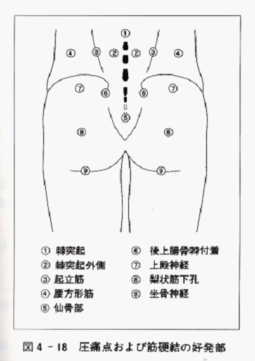 筋筋膜性腰痛症状