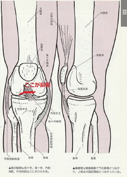 前十字靭帯とは